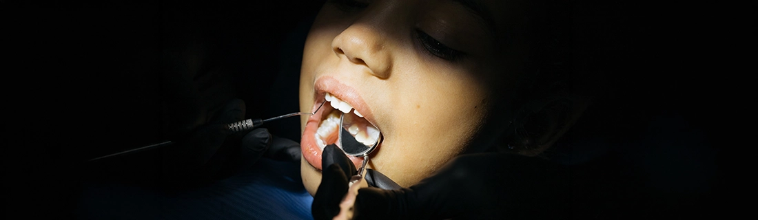 Incipient Lesions in Stockton CA